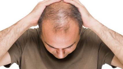 Men's Hair Loss